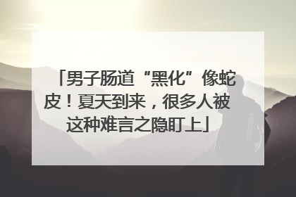 男子肠道“黑化”像蛇皮！夏天到来，很多人被这种难言之隐盯上